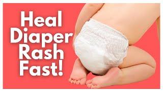 Ultimate Diaper Rash Guide - Tips For Tough Diaper Rashes