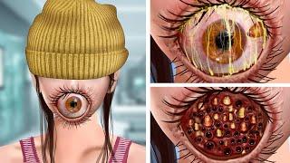 ASMR Remove the Parasitic Giant Eye & Maggots on the mouth  Deep Cleaning Animation