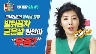 메디텔 발뒤꿈치 굳은살의 원인이 이것?굳은살 발냄새 있으신 분들은 주목