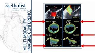 Multi-Modality Case Presentations by Advanced CV Imaging Fellows Dipan J. Shah MD May 31 2022