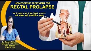 Rectal Prolapse Treatment without Surgeryकांच निकलने मलद्वार  का बाहर निकलनाजाने होम्योपैथिक ईलाज