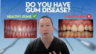 Gum Disease  What you need to know before treatment