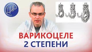 Варикоцеле 2 степени можно ли обойтись без операции? Андролог-уролог ЦИР Живулько А.Р.