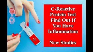 C-Reactive Protein Test - Find Out If You Have Inflammation