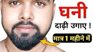 दाढ़ी को घना करने का सबसे आसान तरीका  Dadhi Kaise Ugaya  Dadhi Kaise Badhaye  Beard Growth