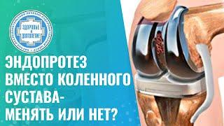  Эндопротез вместо коленного сустава - менять или нет?