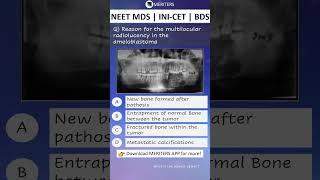 NEET MDS  INI-CET MDS  PSC  BDS - Most Important Questions  #neetmds2025 #mdsprep