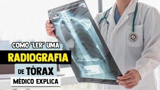 Como INTERPRETAR uma RADIOGRAFIA de Tórax │ Passo a Passo Explicado ABCDE