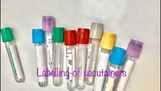 pre analytical variables in phlebotomy labelling blood samples