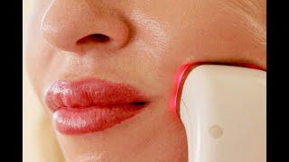 HOW TO USE HOME RF RADIOFREQUENCY DEVICES FOR FACELIFTING AND SKIN TIGHTENINGDIY AT-HOME RF TIPS