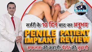 Life-Changing Penile Implant A Patients Journey to Renewed Confidence  10 Days Post-Op