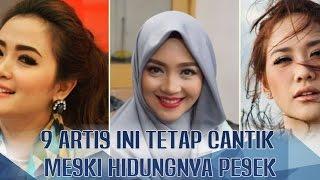 BOHAY SICH 9 Artis ini Tetap Cantik dan Menawan Meski Hidungnya Pesek