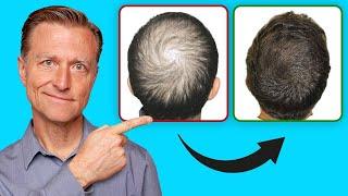 How to Regrow Your Hair UPDATED VITAL INFO