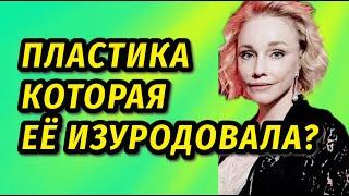 «Улыбка Джокера» В сети активно обсуждают неудачную пластику Марины Зудиной личная жизнь биография