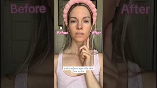 ZIIP HALO MICROCURRENT DEVICE TUTORIAL  AT HOME FACE LIFT #skincare #skinhacks #antiagingskincare