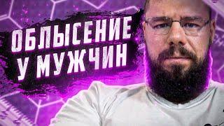 Облысение у мужчин. Андрогенная алопеция. Лучшие методи лечения и профилактики