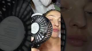 TRYING THE BEST FACIALS IN TORONTO PART 8.5 radford studio milia removal