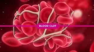 Coagulation Cascade Explained