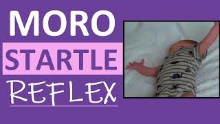 Moro Reflex Newborn Test  Startle Reflex  Pediatric Nursing Assessment