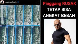 Pembahasan Hasil MRI OM DEDDY CORBUZIER