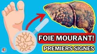 LE FOIE est en train de MOURIR 15 Signes étranges de DOMMAGES AU FOIE