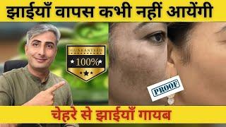 झाईयां 100% खत्म हुई I  लोट कर नहीं आई I  झाइयों का 100% इलाज़।  DR. MANOJ DAS #drmanojdas