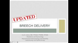 Breech delivery