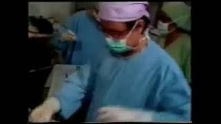 Operasi Tubectomy - Steril pada Wanita - MOW