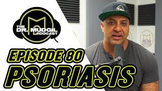 PSORIASIS - The Dr. Mudgil Podcast - Episode 80