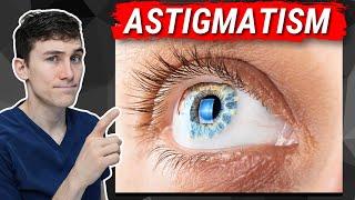 Astigmatism Explained - What You Need to Know