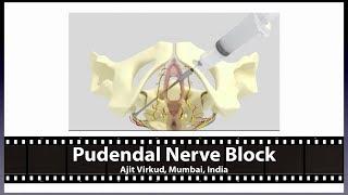 Pudendal Nerve Block