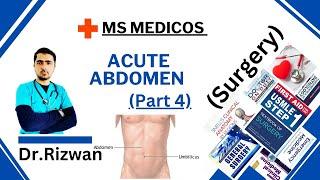 Michaels diverticulumAcute abdomenSurgeryMS Medicos Dr. RizwanUrdu Hindi Easy Explanations