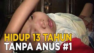 Sudah 13 tahun lamanya anakku hidup tanpa anus  KEJAMNYA DUNIA