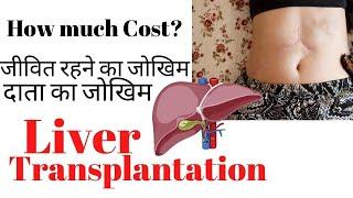 Liver transplantation cost survival rate and donor risk  Liver transplant kitna success hai