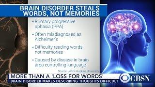 New study Loss for words can be rare brain disorder