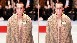 Студентка стала моделью Gucci после удаления опухоли мозга  StarHit.ru