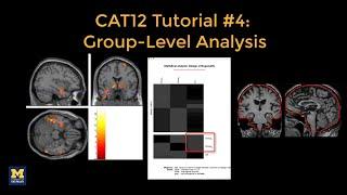 CAT12 #4 Group-Level Analysis