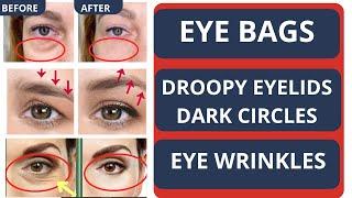 ANTI-AGING FACE EXERCISES FOR EYE BAGS EYE WRINKLES DARK CIRCLES & TIGHTEN DROOPY EYELIDS  MIX