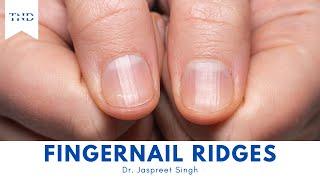 Do You Have Vertical Ridges On Your Fingernails? Heres What They Mean