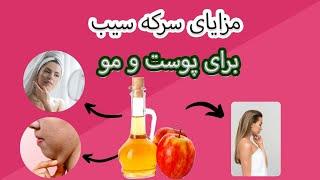 فواید سرکه سیب برای پوست و مو  خواص سرکه سیب برای لاغری