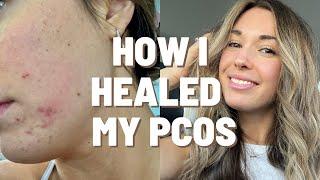 HOW TO NATURALLY HEAL PCOS  supplements weight loss and clearing acne