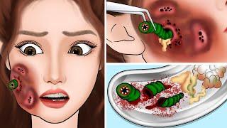 ASMR Help the girl remove the worm that ate her cheek  Be careful when going into the forest