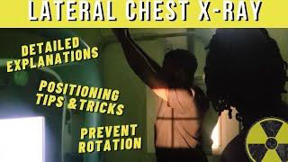 How get a TRUE Lateral Chest X-ray Prevent rotation  Ask The Rad Tech