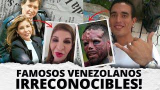 MIRA ESTAS 8 TRANSFORMACIONES Físicas de famosos Venezolanos 