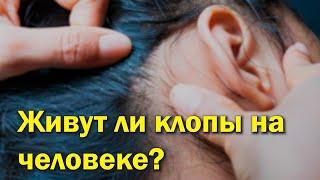 Живут ли клопы на человеке?