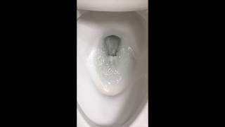Unclog Toilet Bowl Siphon Jet Hole to Improve Flushing