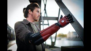 Metal Gear Solid Bionic Arm