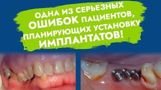 Имплантация зубов. Ошибки и осложнения.