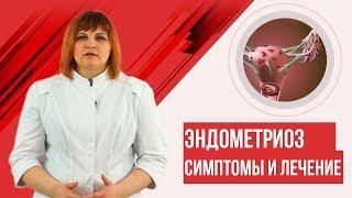 Эндометриоз. Симптомы лечение. 3D