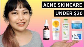 Building an Affordable Acne Routine Bumper Guide Teens and not-Teens